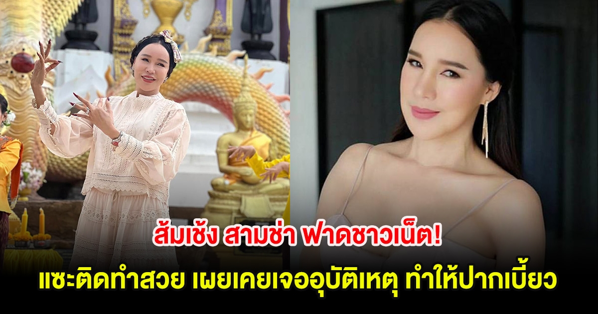 ส้มเช้ง สามช่า ฟาดชาวเน็ต! แซะติดทำสวย เผยเคยเจออุบัติเหตุ ทำให้ปากเบี้ยว