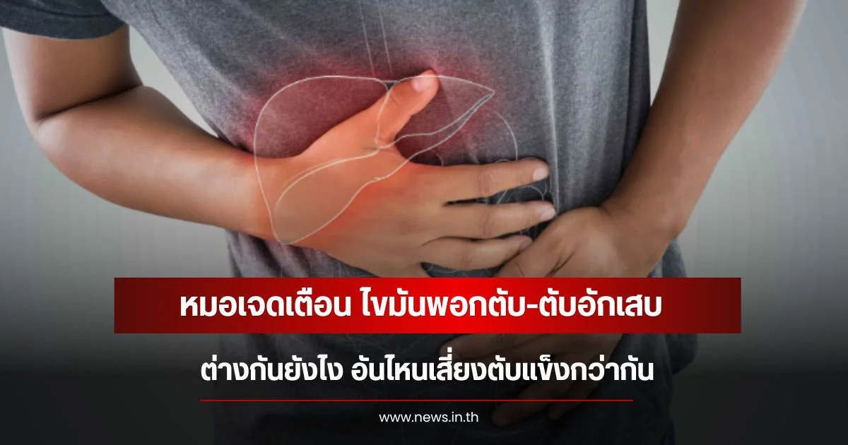 หมอเจดเตือน ไขมันพอกตับ-ตับอักเสบ ต่างกันยังไง อันไหนเสี่ยงตับแข็งกว่ากัน